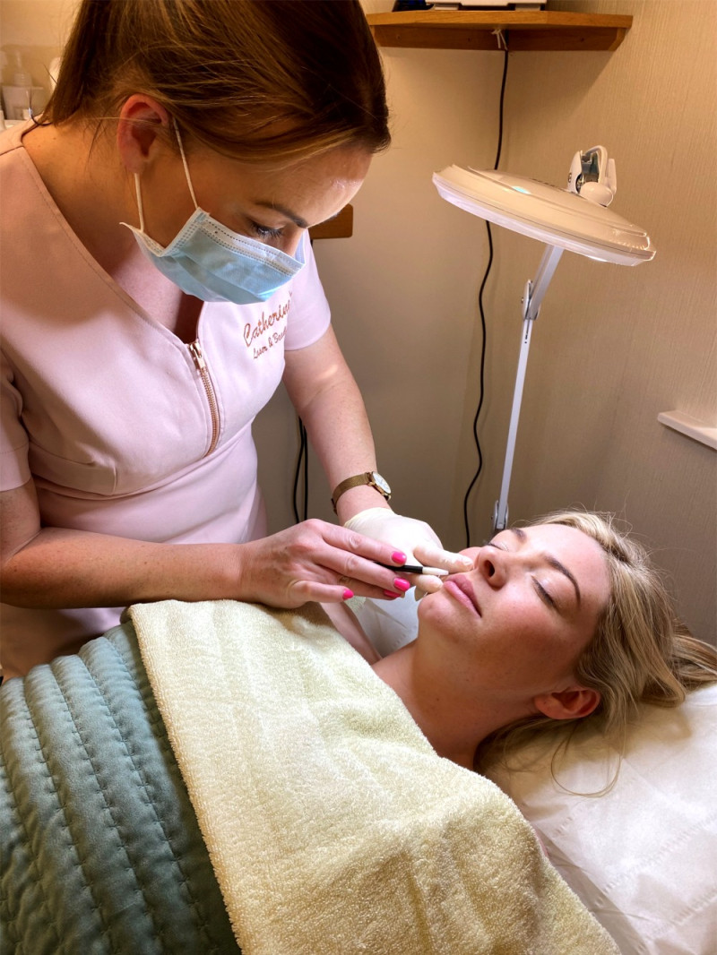 Apilus Electrolysis Hair Removal from the face at Catherine's Laser & Beauty Salon, Letterkenny, Co. Donegal, Ireland